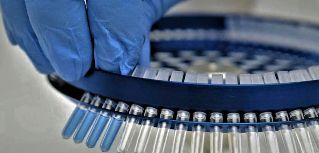 novoe-laboratornoe-oborudovanie-pribylo-v-turkmenistan-dlya-usileniya-potenciala-diagnostiki