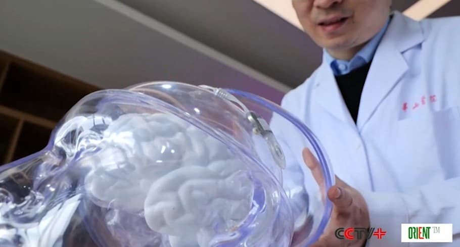 China approves world’s first invasive brain-computer interface medical device