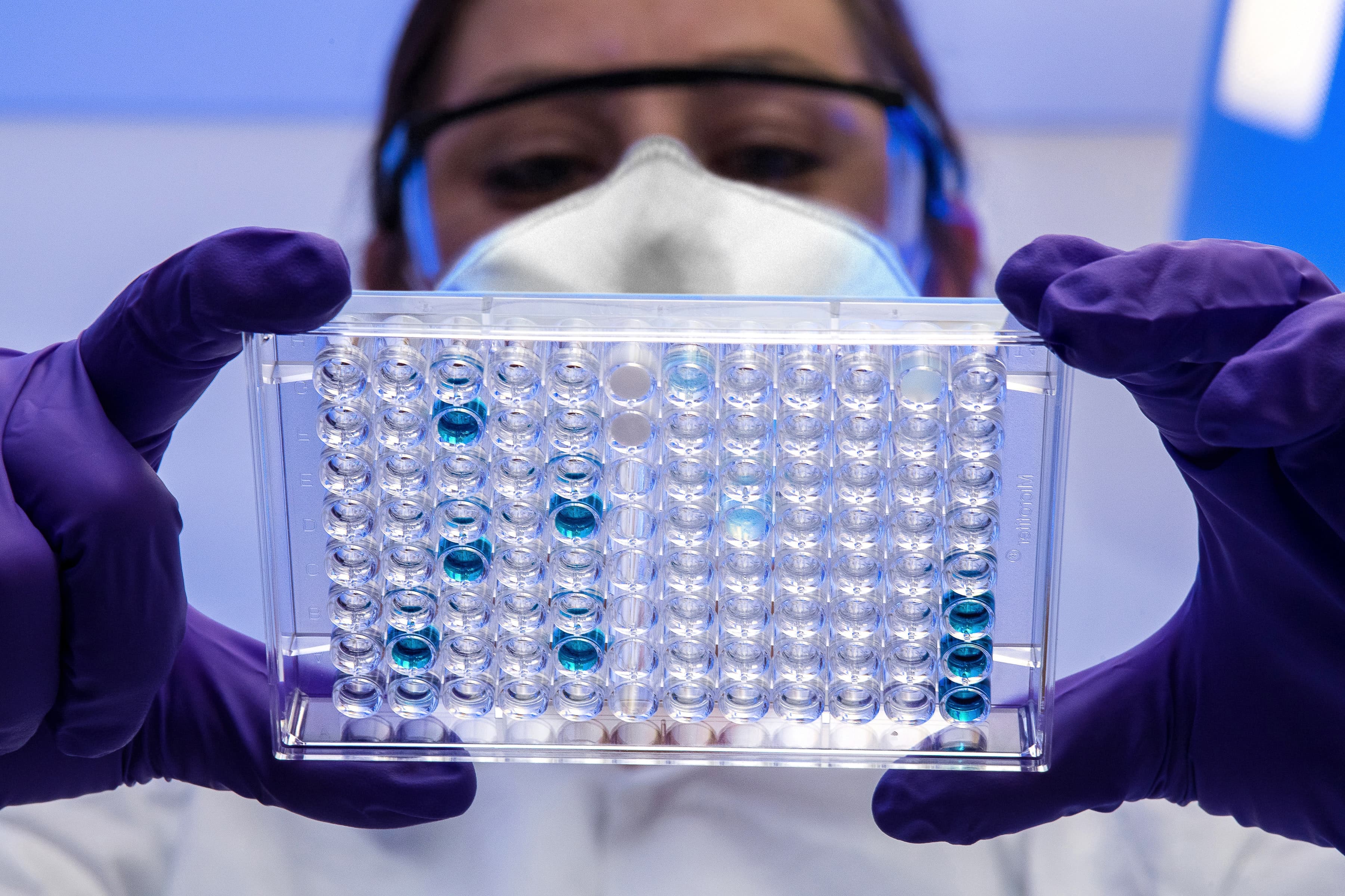 A study by Turkmen scientists has shown where one of the types of flu got into the country from