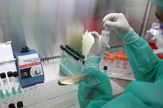 dlya-medicinskih-laboratorij-turkmenistana-postupila-novaya-partiya-reagentov-na-13-mln